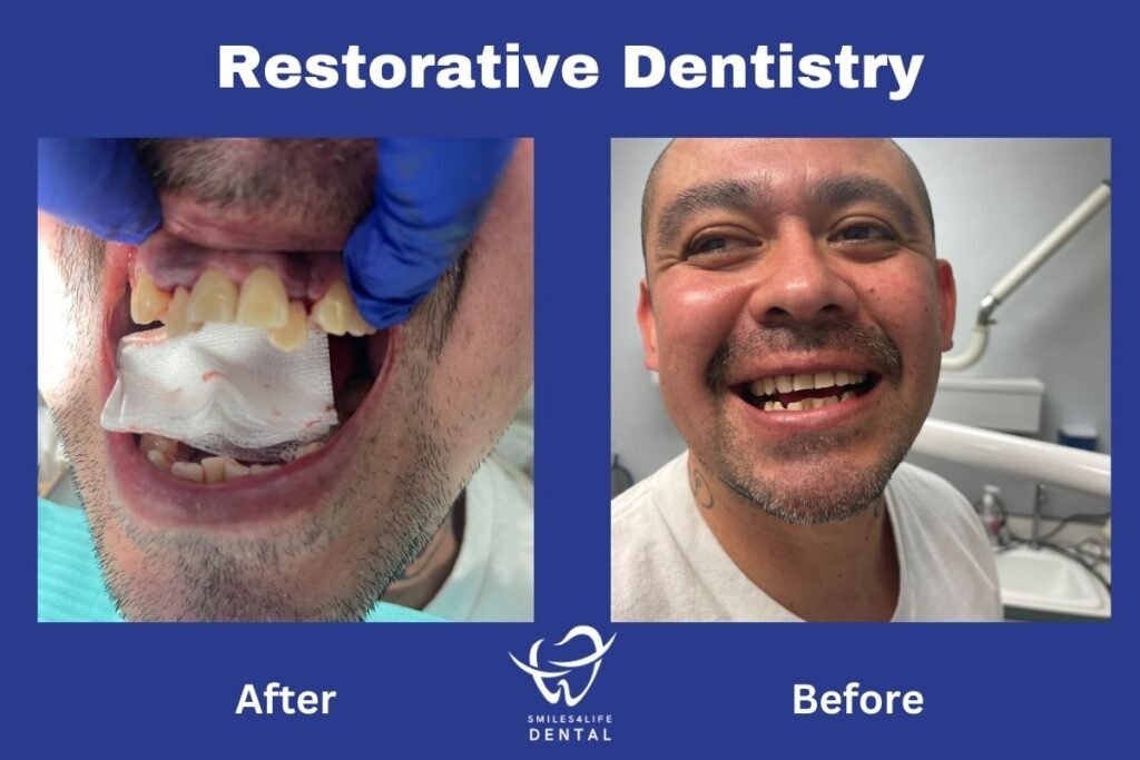 Revitalizing Smiles: Before-and-After Restorative Dentistry